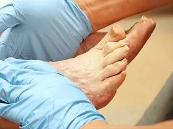 Diabetic Foot Care